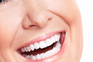 implants-dentaires refaire-son-appareil-dentaire